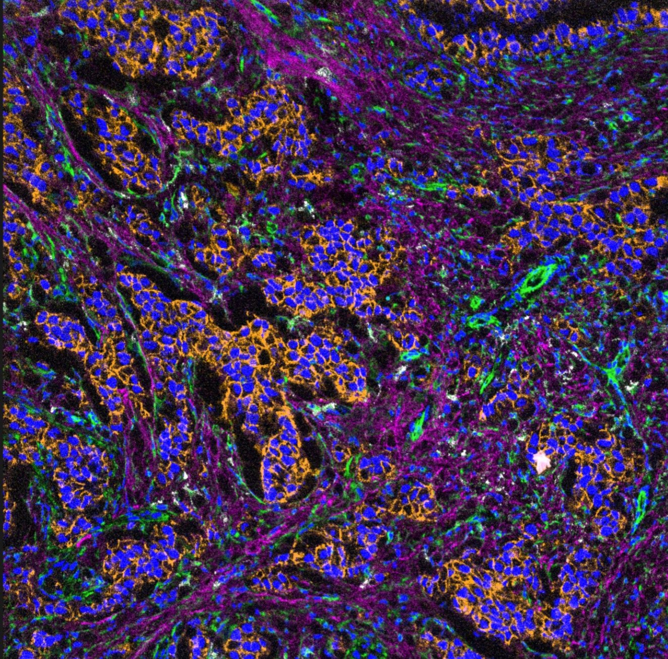 A spatial proteomics image with cells coloured blue, orange, green and magenta by protein