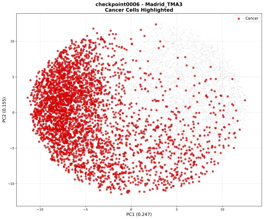 PCA plot with cancer cells highlighted in red