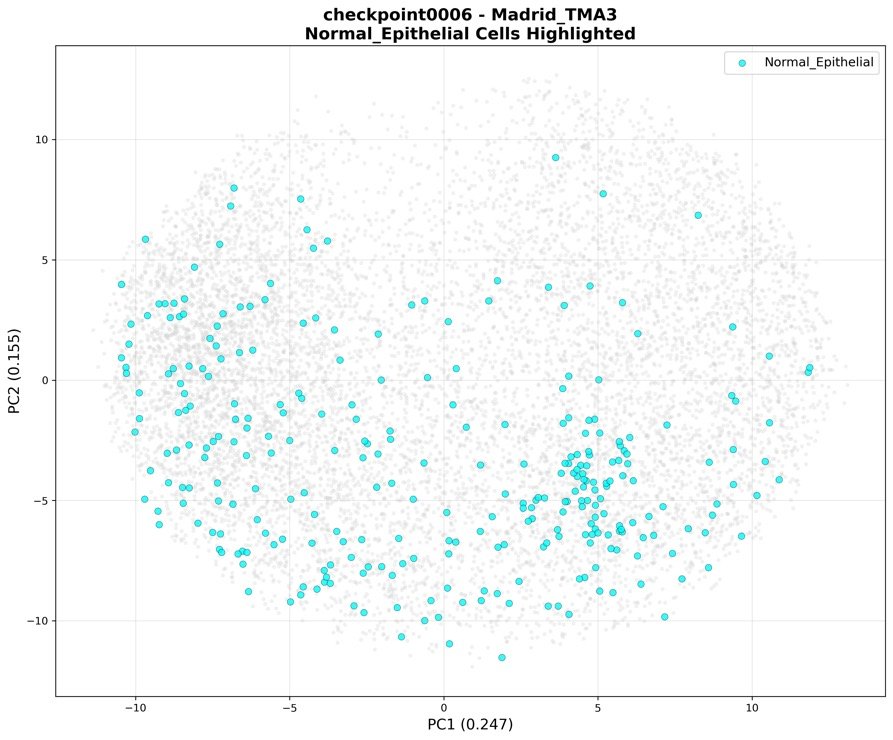 PCA plot with normal epithelial cells highlighted in cyan