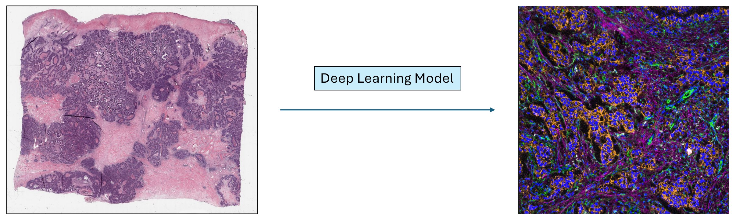 An H&E whole-slide image, an arrow labelled Deep Learning Model, and the corresponding spatial proteomics image