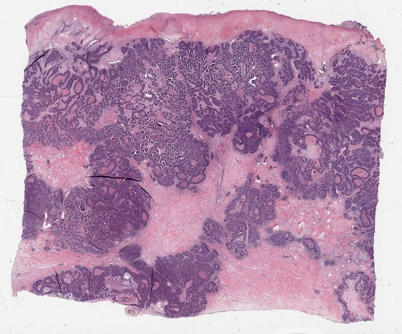 A whole-slide H&E image: purple clusters of cells surrounded by pink tissue
